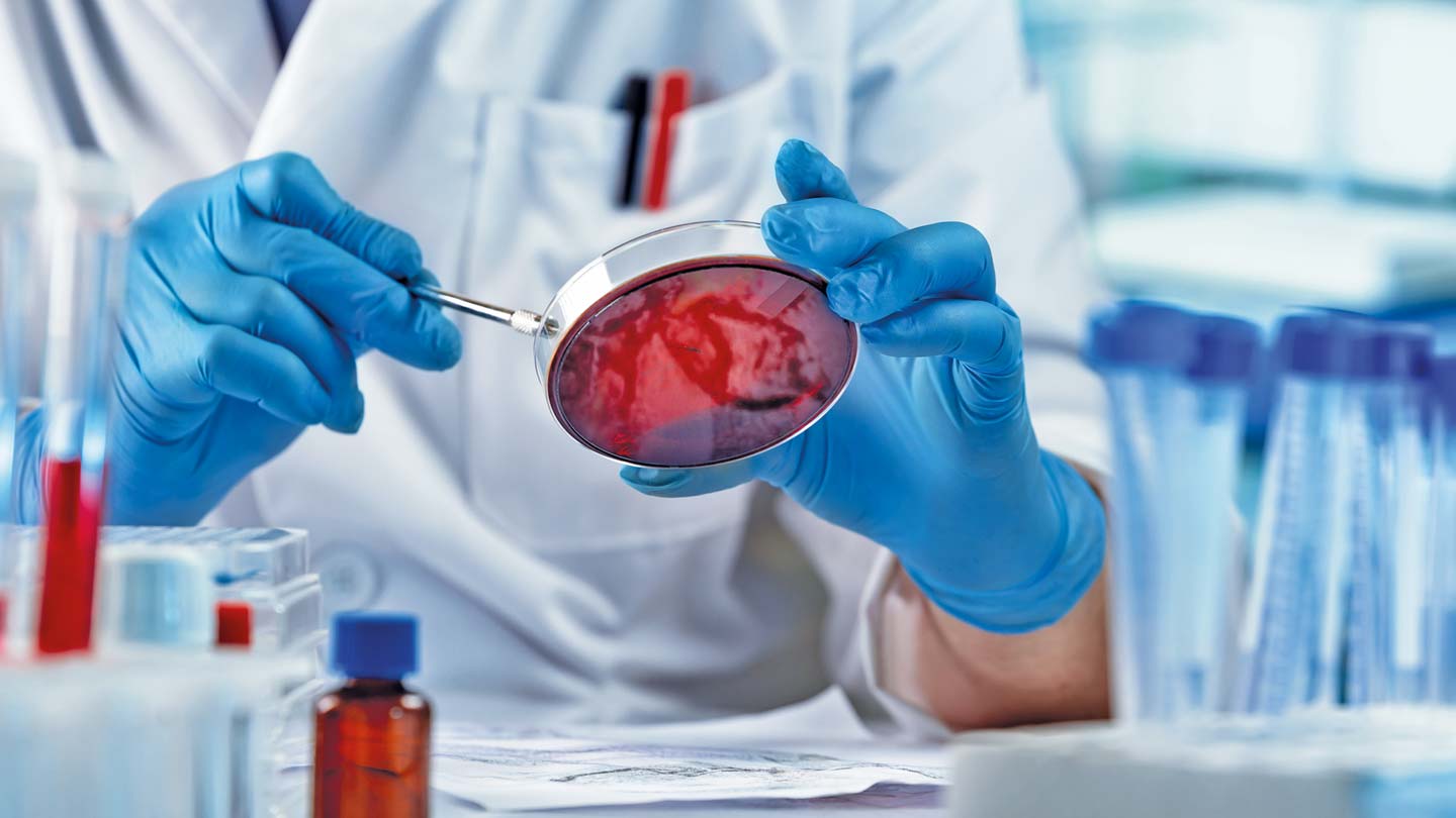 Listerienreduktion mit Hochdruck und Phagen