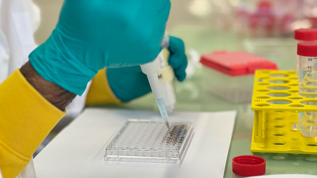 Nahaufnahme einer Laborarbeit: Eine Person mit Handschuhen pipettiert eine Probe in eine Mikrotiterplatte (Multiwell-Plate). Daneben stehen Reaktionsgefäße in einem Probenständer. Das Bild steht für präzise Probenvorbereitung, biochemische Analytik, Screening- und Messverfahren sowie Qualitätskontrolle in Forschung und Lebensmittelanalytik.